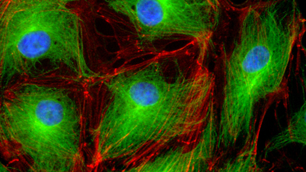 Tế bào nội mô dưới kính hiển vi huỳnh quang